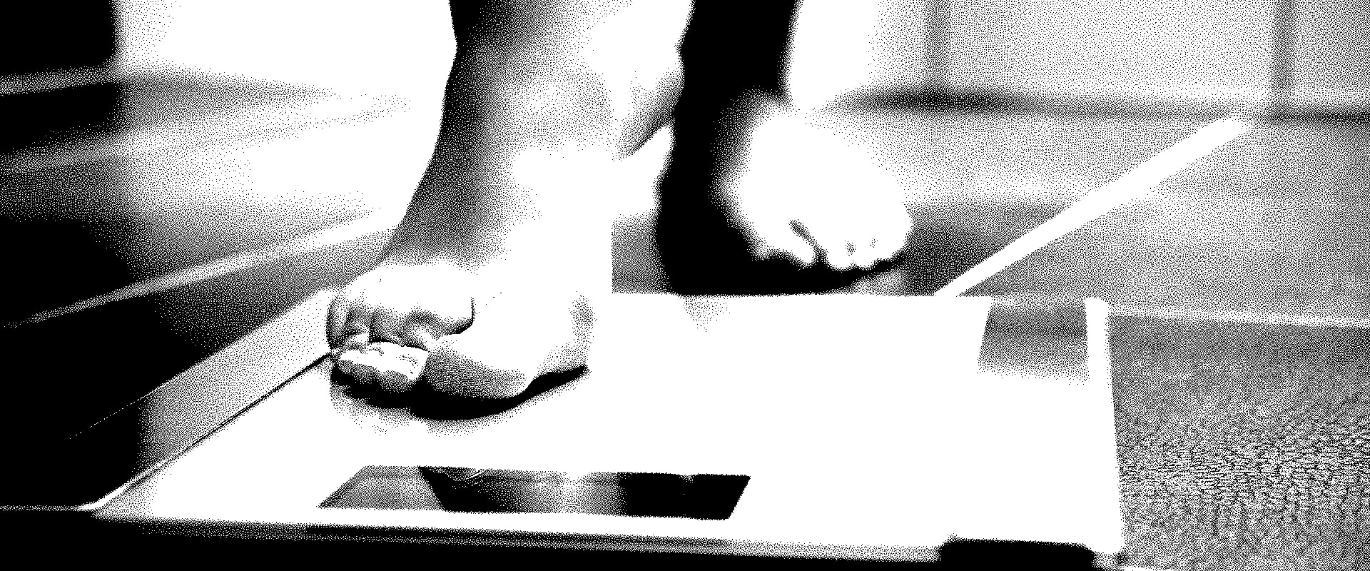 What weight qualifies as anorexia?